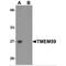 Transmembrane Protein 59 antibody, MBS150213, MyBioSource, Western Blot image 