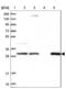 Lactamase Beta 2 antibody, NBP1-92064, Novus Biologicals, Western Blot image 