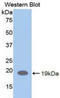 LIF Receptor Subunit Alpha antibody, LS-C303982, Lifespan Biosciences, Western Blot image 