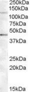 Tankyrase 2 antibody, NBP1-28497, Novus Biologicals, Western Blot image 