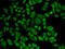 Aldehyde dehydrogenase, mitochondrial antibody, 14-336, ProSci, Immunofluorescence image 