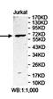 Zinc Finger Protein 317 antibody, orb78386, Biorbyt, Western Blot image 