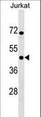 IKBKB Interacting Protein antibody, LS-C159895, Lifespan Biosciences, Western Blot image 