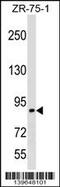 RAS P21 Protein Activator 3 antibody, 60-278, ProSci, Western Blot image 