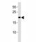 O-6-Methylguanine-DNA Methyltransferase antibody, F50325-0.4ML, NSJ Bioreagents, Immunohistochemistry paraffin image 