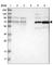 Receptor Interacting Serine/Threonine Kinase 2 antibody, HPA016499, Atlas Antibodies, Western Blot image 