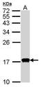 Cytidine Deaminase antibody, PA5-27478, Invitrogen Antibodies, Western Blot image 