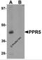 Proline Rich 5 antibody, 6291, ProSci, Western Blot image 
