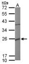 Potassium Calcium-Activated Channel Subfamily M Regulatory Beta Subunit 1 antibody, NBP1-33484, Novus Biologicals, Western Blot image 