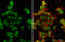 DNA Methyltransferase 3 Alpha antibody, GTX129125, GeneTex, Immunofluorescence image 