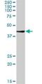 Chitobiase antibody, H00001486-D01P, Novus Biologicals, Western Blot image 