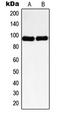Nibrin antibody, LS-C352568, Lifespan Biosciences, Western Blot image 