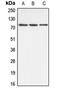 ATP Binding Cassette Subfamily B Member 10 antibody, LS-B13629, Lifespan Biosciences, Western Blot image 