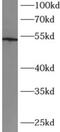 C-X3-C Motif Chemokine Receptor 1 antibody, FNab10034, FineTest, Western Blot image 
