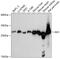 Adenylate Kinase 3 antibody, GTX66453, GeneTex, Western Blot image 