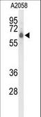 CLPTM1 Like antibody, LS-C168854, Lifespan Biosciences, Western Blot image 