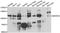 Mitogen-Activated Protein Kinase Kinase Kinase Kinase 3 antibody, A7351, ABclonal Technology, Western Blot image 