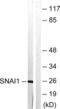 Snail Family Transcriptional Repressor 1 antibody, abx012844, Abbexa, Western Blot image 