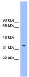 Solute Carrier Family 25 Member 1 antibody, TA333930, Origene, Western Blot image 