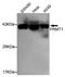 Protein Arginine Methyltransferase 1 antibody, STJ99141, St John