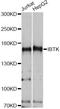 Inhibitor Of Bruton Tyrosine Kinase antibody, A14866, ABclonal Technology, Western Blot image 