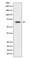 Dihydropyrimidinase Like 4 antibody, M12176, Boster Biological Technology, Western Blot image 