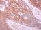 Parathyroid Hormone Like Hormone antibody, GTX100762, GeneTex, Immunohistochemistry paraffin image 