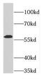 Phenylalanyl-TRNA Synthetase Subunit Alpha antibody, FNab03014, FineTest, Western Blot image 