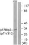 Cyclin Dependent Kinase Inhibitor 1C antibody, PA5-38507, Invitrogen Antibodies, Western Blot image 
