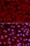 Adrenoceptor Beta 2 antibody, orb135018, Biorbyt, Immunofluorescence image 