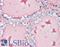 Thyroglobulin antibody, LS-B3170, Lifespan Biosciences, Immunohistochemistry frozen image 