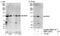 RNA Binding Motif Protein 5 antibody, NBP1-26613, Novus Biologicals, Western Blot image 