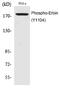 Erbb2 Interacting Protein antibody, PA5-40198, Invitrogen Antibodies, Western Blot image 