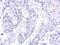 Zinc Finger Protein 571 antibody, GTX119554, GeneTex, Immunohistochemistry paraffin image 
