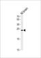 Tumor protein D52 antibody, PA5-72194, Invitrogen Antibodies, Western Blot image 