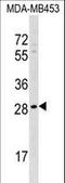 Axin Interactor, Dorsalization Associated antibody, LS-C161024, Lifespan Biosciences, Western Blot image 