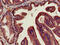 Dipeptidyl Peptidase 4 antibody, CSB-PA06229A0Rb, Cusabio, Immunohistochemistry paraffin image 