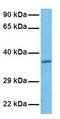 Asialoglycoprotein Receptor 2 antibody, GTX77833, GeneTex, Western Blot image 