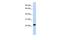 Ubiquitin C-Terminal Hydrolase L3 antibody, GTX44828, GeneTex, Western Blot image 