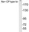 Sodium Voltage-Gated Channel Alpha Subunit 1 antibody, LS-C199931, Lifespan Biosciences, Western Blot image 