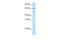 Adenosine Deaminase TRNA Specific 1 antibody, PA5-41836, Invitrogen Antibodies, Western Blot image 