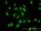 Proteasome Subunit Alpha 4 antibody, H00005685-M01, Novus Biologicals, Immunocytochemistry image 