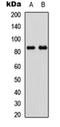 Glycogen Synthase 1 antibody, orb256578, Biorbyt, Western Blot image 