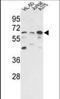 Protein Phosphatase 3 Catalytic Subunit Gamma antibody, orb94876, Biorbyt, Western Blot image 