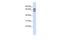 Tripartite Motif Family Like 1 antibody, GTX46879, GeneTex, Western Blot image 