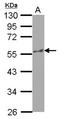 Katanin Catalytic Subunit A1 antibody, NBP2-17019, Novus Biologicals, Western Blot image 