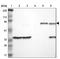 Annexin A6 antibody, NBP1-90150, Novus Biologicals, Western Blot image 