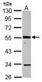Purinergic Receptor P2X 2 antibody, LS-C155588, Lifespan Biosciences, Western Blot image 