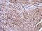 MTOR Associated Protein, LST8 Homolog antibody, GTX132580, GeneTex, Immunohistochemistry paraffin image 