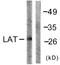 Linker For Activation Of T Cells antibody, LS-C117664, Lifespan Biosciences, Western Blot image 